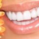 Einfach schöne Zähne