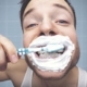 Richtiges Zähneputzen bei Erwachsenen