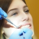 Defekte Zahnfüllungen Zahnfüllung rausgefallen?